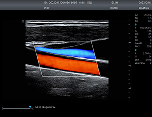 Carotid